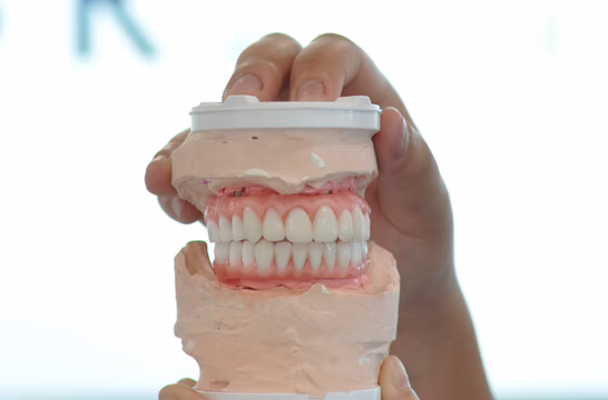 Full smile makeover result